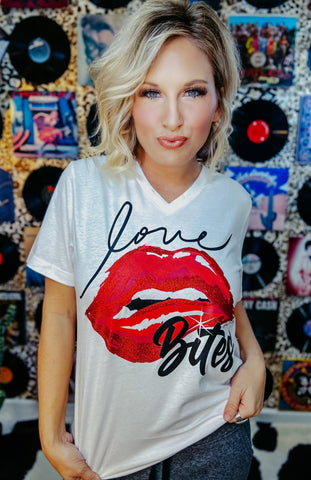 Love Bites